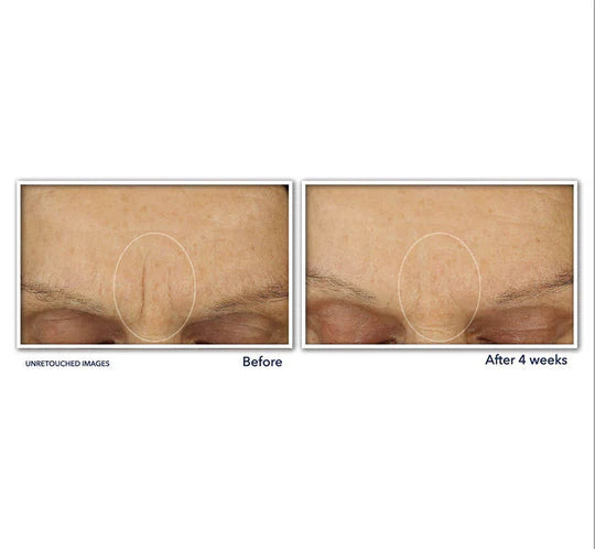 RoC Retinol Correxion Line Smoothing Max Hydration Cream 48g
