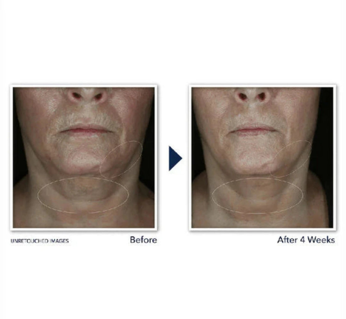 RoC Derm Correxion Contour Cream 48g - MANSH