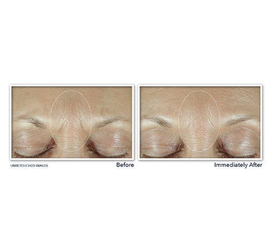 RoC Derm Correxion Fill + Treat Serum 15ml - MANSH