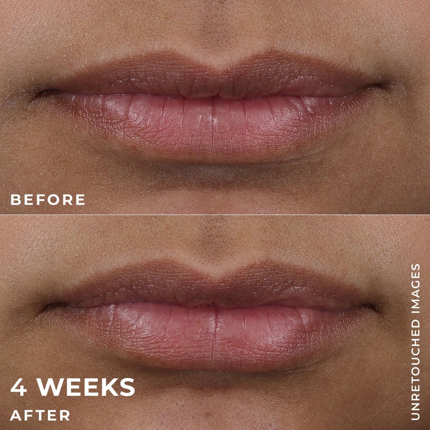 RoC Derm Correxion® Lip Volumizer + Pro-Collagen Peptide - MANSH