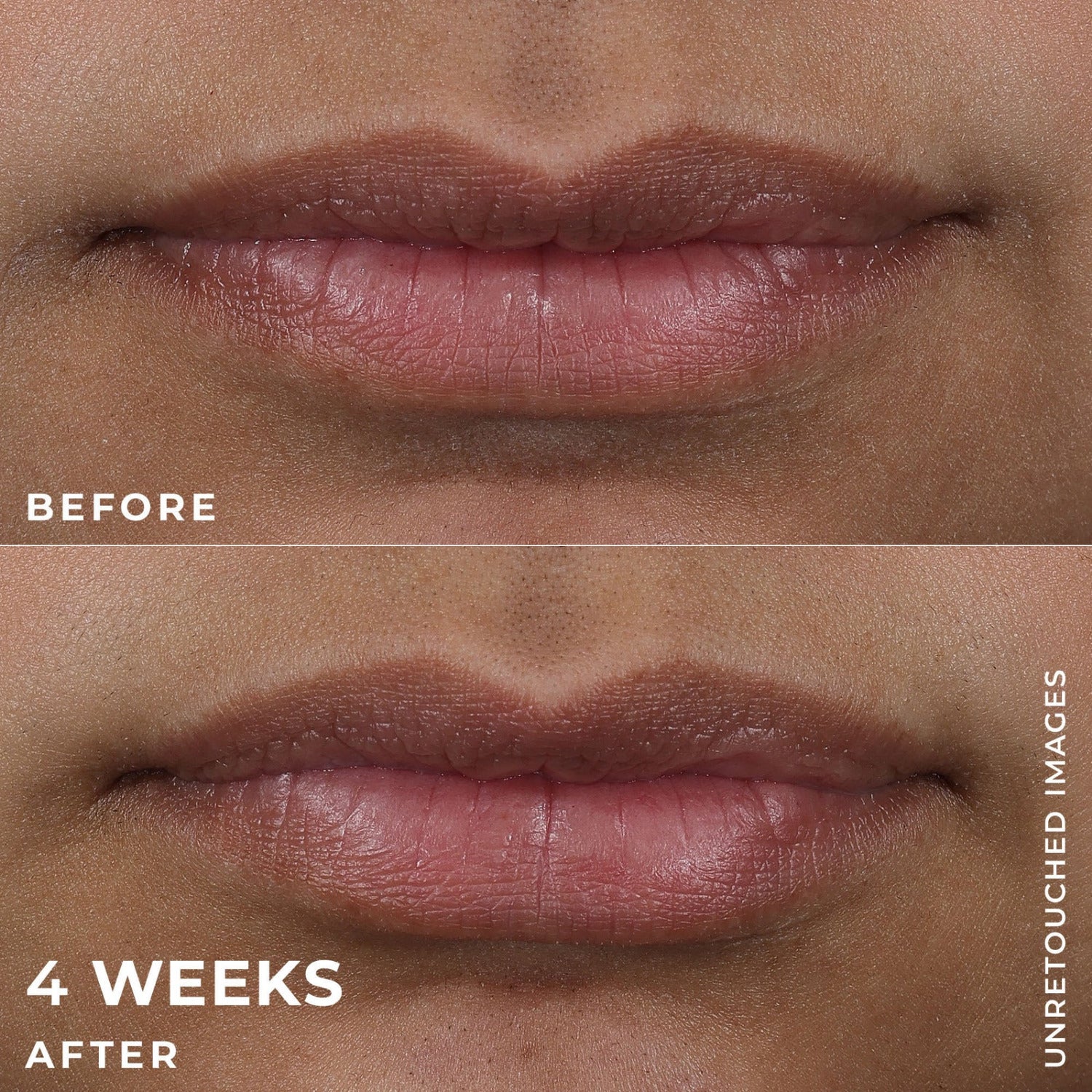 RoC Derm Correxion® Lip Volumizer + Pro-Collagen Peptide