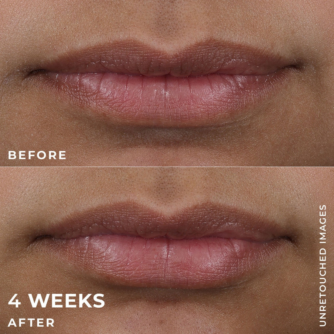 RoC Derm Correxion® Lip Volumizer + Pro-Collagen Peptide