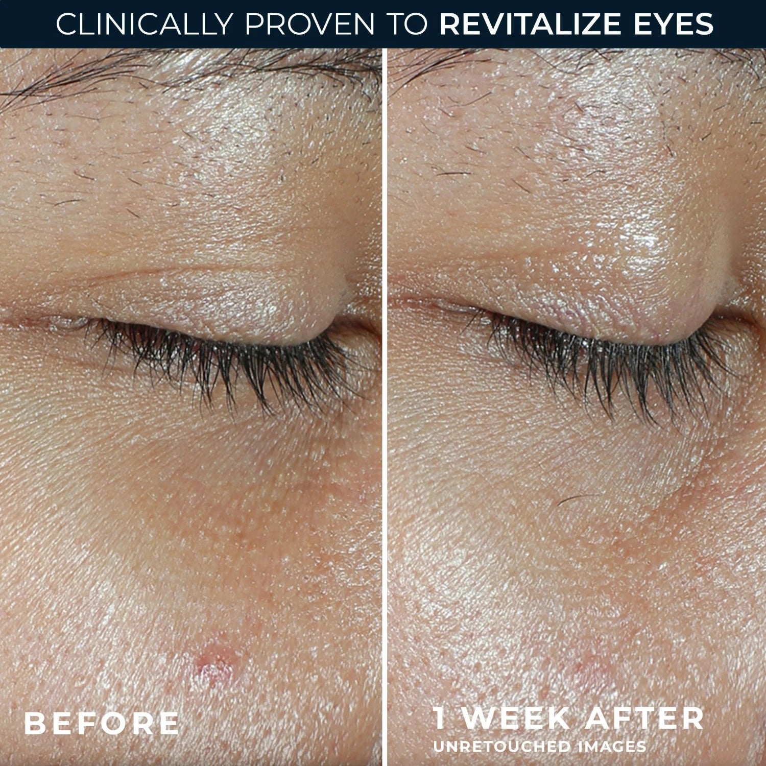 RoC Multi Correxion Revive + Glow Eye Balm with Vitamin C (4g) bright eyes in just 1 week