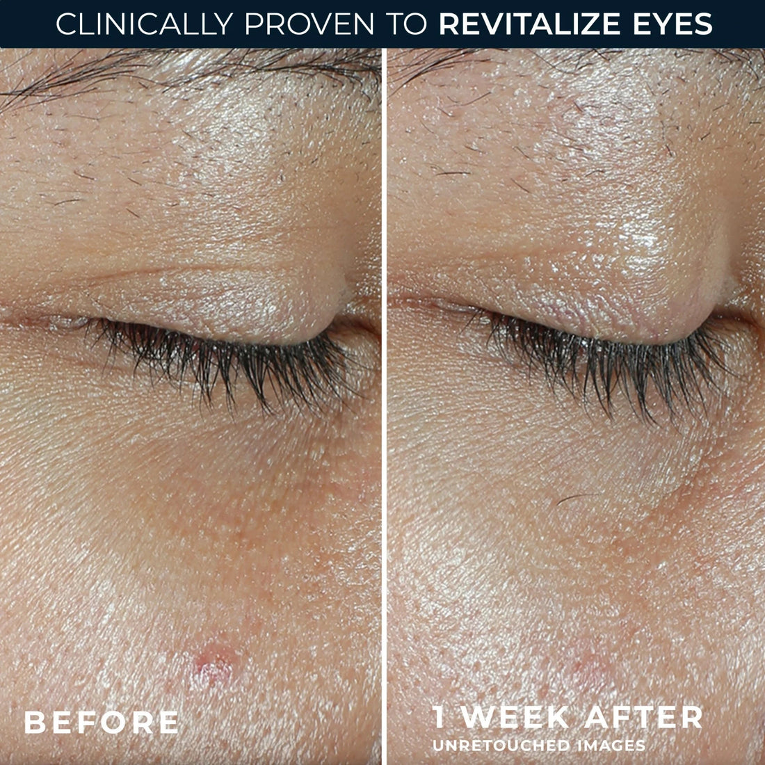 RoC Multi Correxion Revive + Glow Eye Balm with Vitamin C (4g) bright eyes in just 1 week