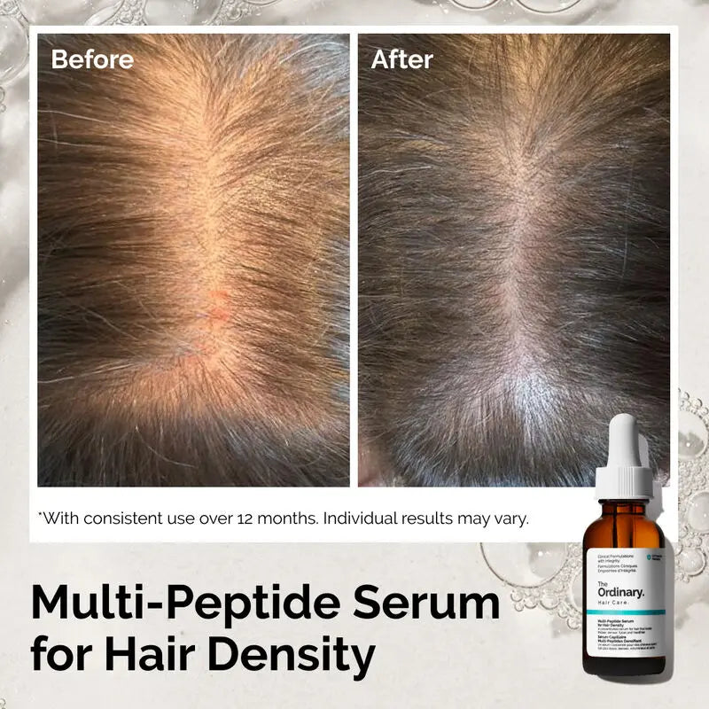 Before and after comparison of hair density on a person's scalp, with text reading 'Before', 'After', and 'Multi-Peptide Serum for Hair Density', plus a small bottle of Ordinary Multi-Peptide Serum shown at bottom right.