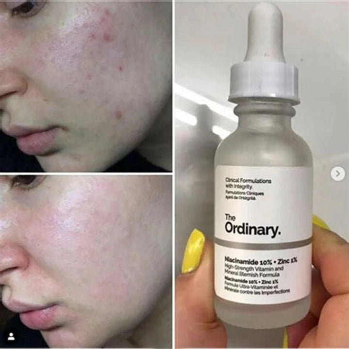 The Ordinary Niacinamide 10% + Zinc 1% 30ml - MANSH